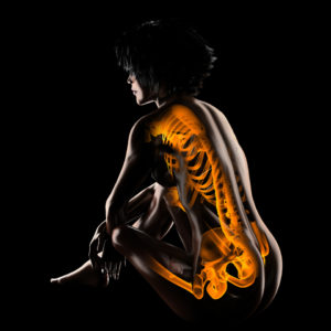 risk factors for Osteoporosis